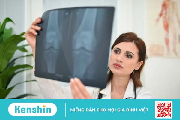 Thông tin chi tiết về kỹ thuật chụp X quang đầu gối 1