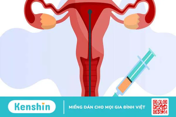 Thụ tinh nhân tạo giá bao nhiêu? 2