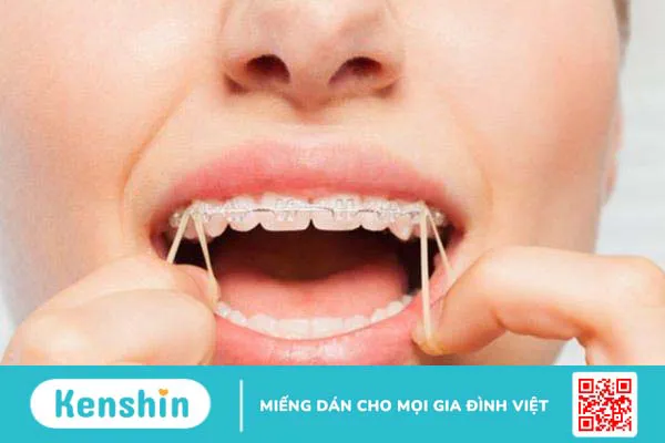 Thun liên hàm là gì? Ưu nhược điểm của thun liên hàm 4