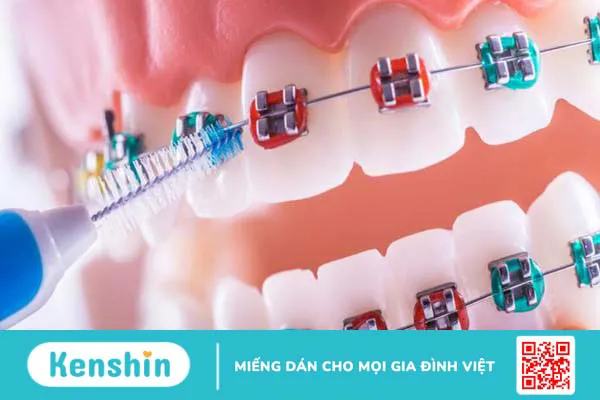 Thun liên hàm là gì? Ưu nhược điểm của thun liên hàm 6