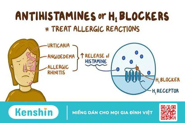 Thuốc kháng Histamin H1 điều gì bệnh gì? Và những điều cần lưu ý 3