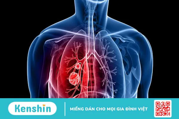 Trong điều trị sốc, thuốc co mạch giúp ổn định trạng thái hô hấp