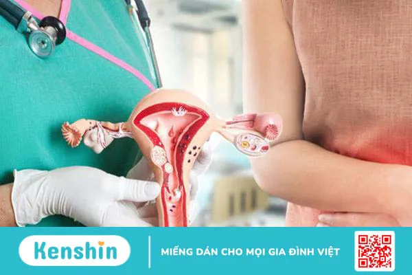 Thụt rửa âm đạo có nên hay không 3