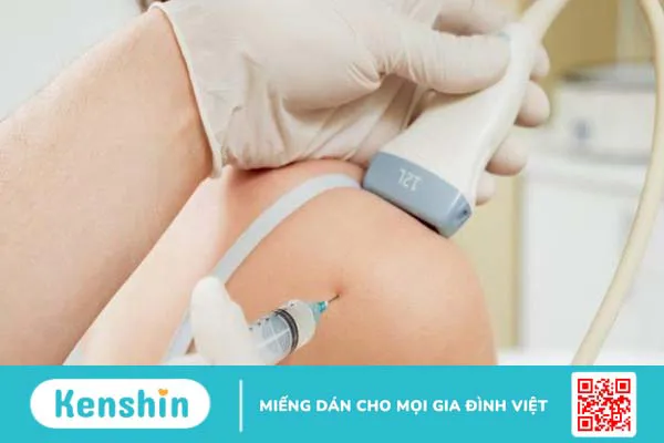 Tiêm phá đông khớp vai dưới: Quy trình thực hiện 3