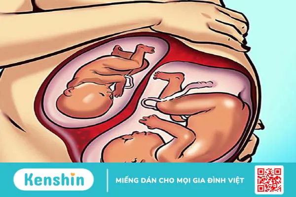 Tiền sản giật là gì? Tiền sản giật khi mang thai có nguy hiểm không? 3