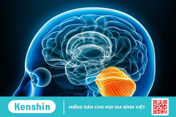 Tiểu não có vai trò gì? Cách phòng ngừa bệnh lý tiểu não 1