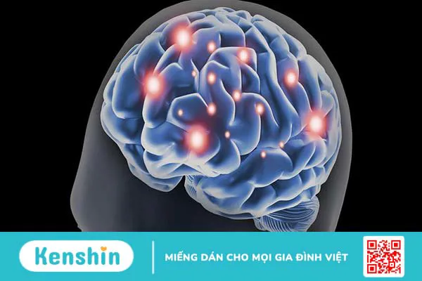 Tìm hiểu bệnh lý tâm thần phân liệt thể thanh xuân 2