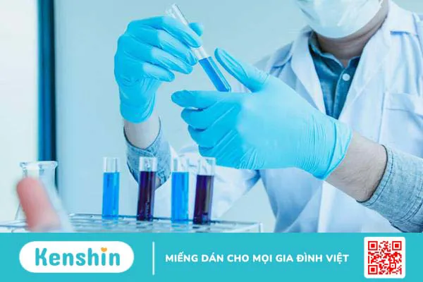 Tìm hiểu IVD là gì? Phân loại các dạng IVD phổ biến mà bạn cần biết 1