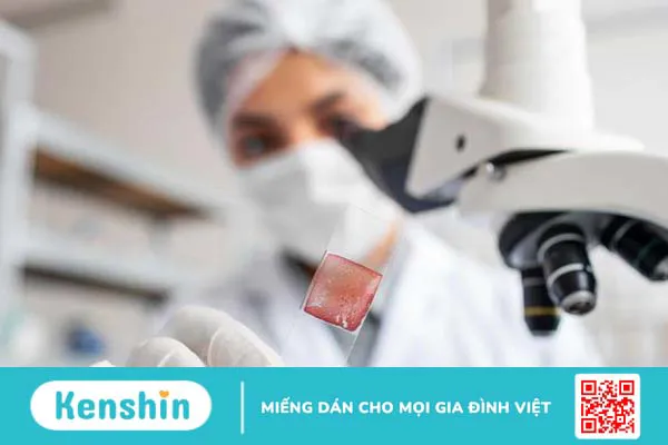 Tìm hiểu IVD là gì? Phân loại các dạng IVD phổ biến mà bạn cần biết 4