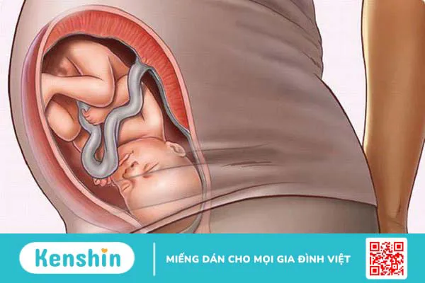 Tìm hiểu ngôi thai thuận là gì? Những dấu hiệu nhận biết ngôi thai thuận 1