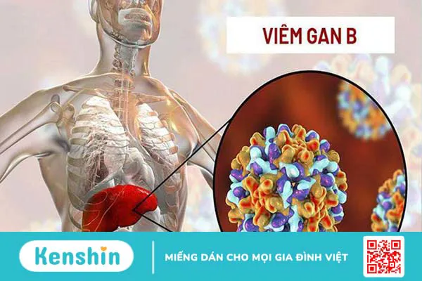 Tìm hiểu người lành mang virus viêm gan b có lây không? 4