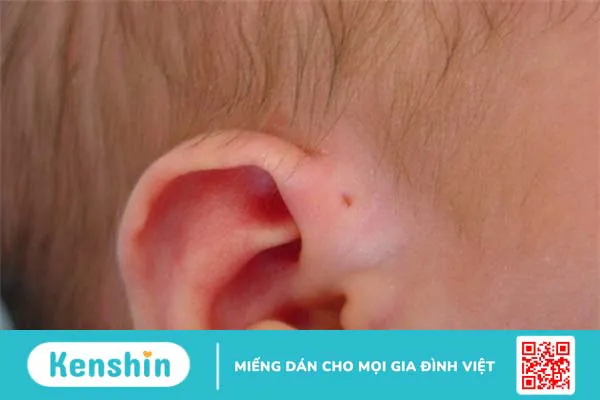 Tìm hiểu vành tai có tác dụng gì với cơ thể? 4