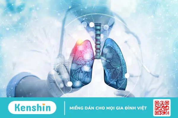 tìm hiểu về các loại ung thư di căn đến phổi 1