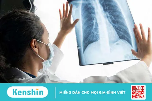 tìm hiểu về các loại ung thư di căn đến phổi 3