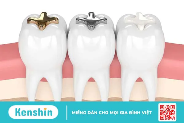 Tìm hiểu về kĩ thuật hàn răng và quy trình hàn răng 1