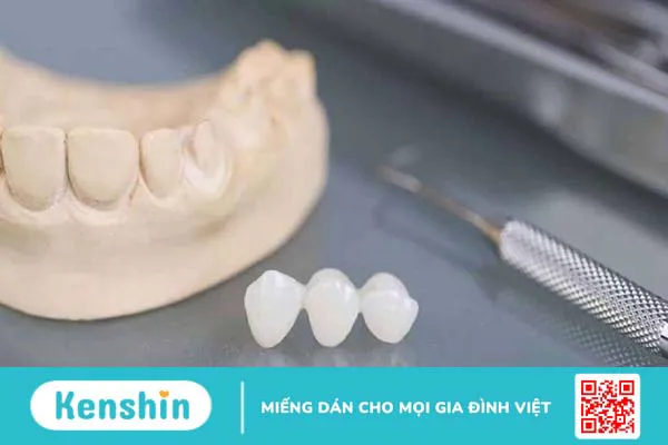 Tìm hiểu về mão răng trong nha khoa thẩm mỹ 1