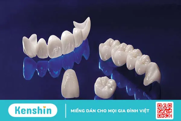 Tìm hiểu về mão răng trong nha khoa thẩm mỹ 2