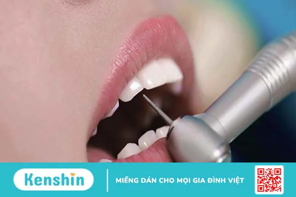 Tìm hiểu về mão răng trong nha khoa thẩm mỹ 4