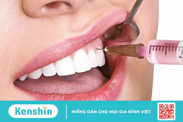 Trụ implant straumann và đặc điểm nổi trội 3