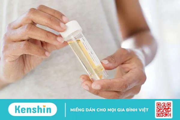 Tìm hiểu ý nghĩa của chỉ số SG trong nước tiểu 1