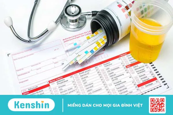 Tìm hiểu ý nghĩa của chỉ số SG trong nước tiểu 2