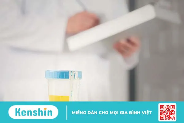 Tìm hiểu ý nghĩa của chỉ số SG trong nước tiểu 4