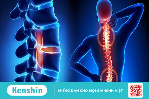 Tổn thương tủy hoàn toàn và những điều cần biết về chúng