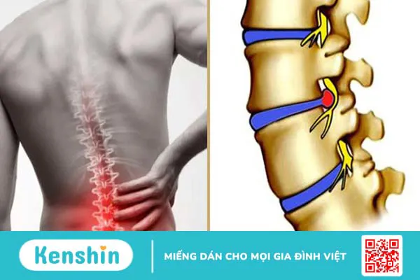 Top 3 bệnh thường gặp của dân văn phòng 1