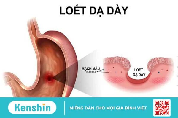 Top 3 bệnh thường gặp của dân văn phòng 2