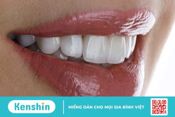 Top 5 dáng răng sứ đẹp, phù hợp với từng khuôn mặt bạn không nên bỏ qua 1