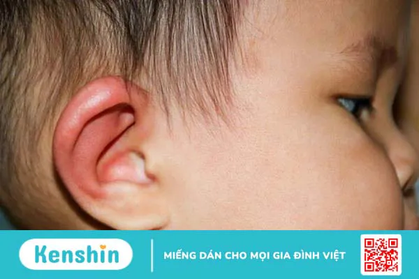 Trẻ 10 tháng tuổi bị nổi hạch sau tai có nguy hiểm không? Nguyên nhân do đâu 1