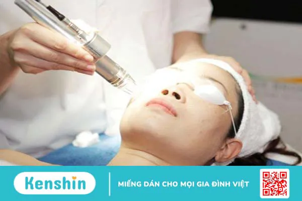 Trị sẹo rỗ đáy vuông hiệu quả - Nỗi băn khoăn của nhiều người 3