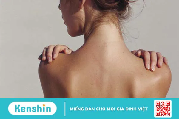 Triệt lông lưng tại nhà đơn giản và hiệu quả? 1