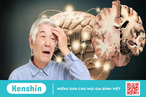 Triệu chứng sa sút trí tuệ là gì? 1