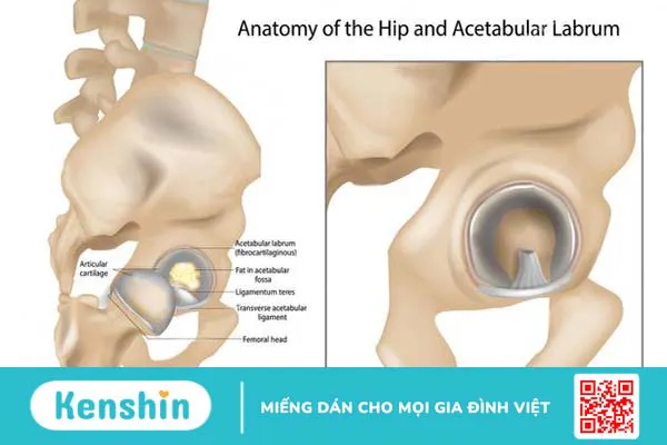 Rách sụn viền ổ cối: Triệu chứng và điều trị 1