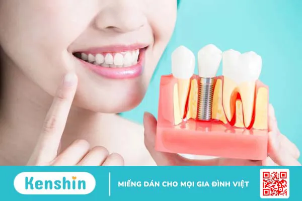 Trồng răng có cần lấy tủy không? 3