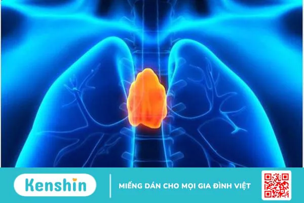 Tuyến ức là gì? Bệnh u tuyến ức là gì? Triệu chứng và phương pháp điều trị 1