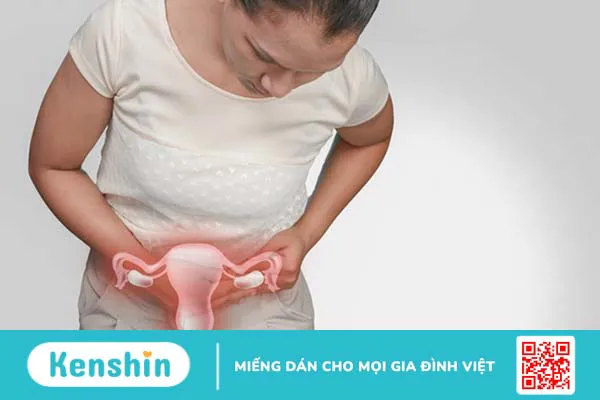 Biến chứng nguy hiểm nhất của u nang buồng trứng có vách ngăn là ung thư buồng trứng