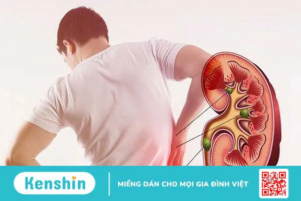 Ù tai liên quan đến thận: Những điều bạn nên biết 2