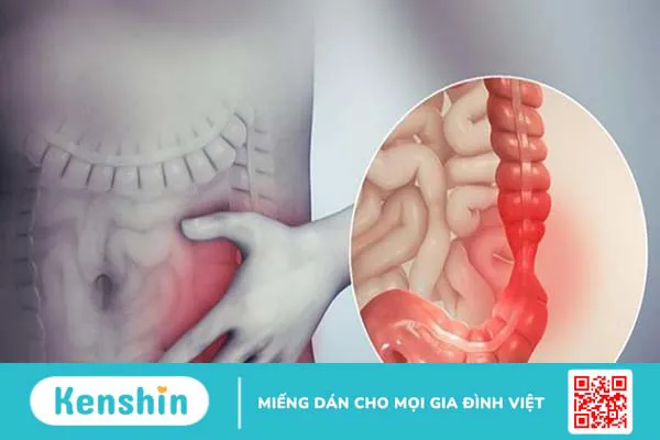 Ung thư ruột non có nguy hiểm không? Dấu hiệu và cách điều trị 1