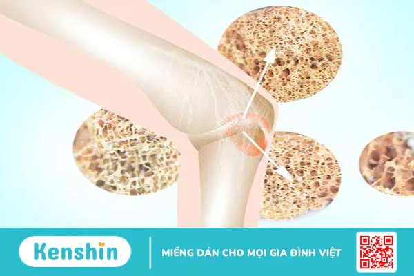 Ung thư tủy xương là gì? Phòng ngừa ung thư tủy xương 1