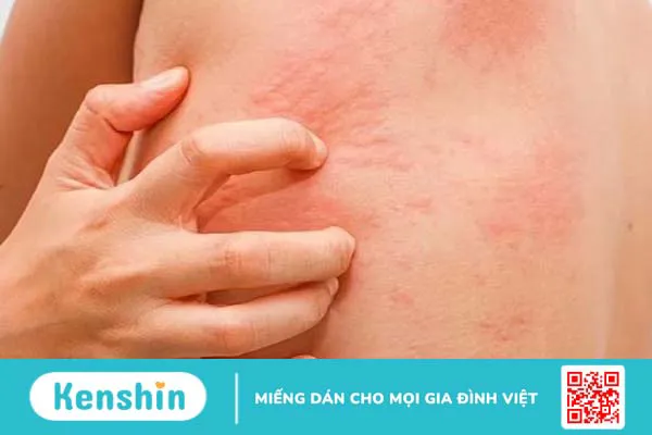 Uống collagen có gây buồn ngủ không? 3