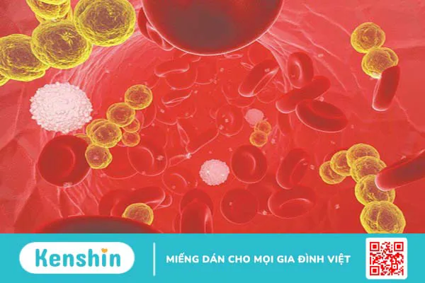 Vi khuẩn Klebsiella Pneumoniae gây ra những triệu chứng gì?