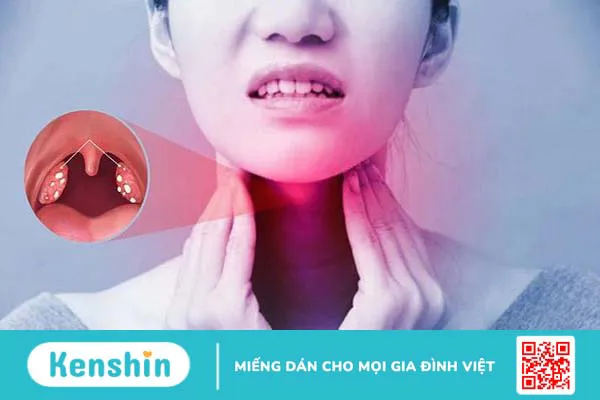 Tình trạng nhiễm amidan tái phát nhiều lần là do sự kết hợp các tác nhân từ đời sống và yếu tố sức khỏe