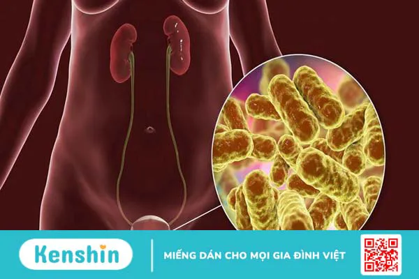 Viêm bàng quang có thai được không - Chị em không thể bỏ qua! 1