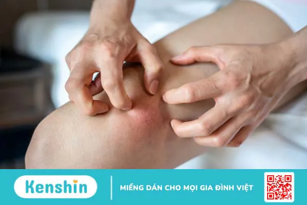 Viêm cơ thể vùi: Nguyên nhân, triệu chứng, chẩn đoán và phương pháp điều trị 2