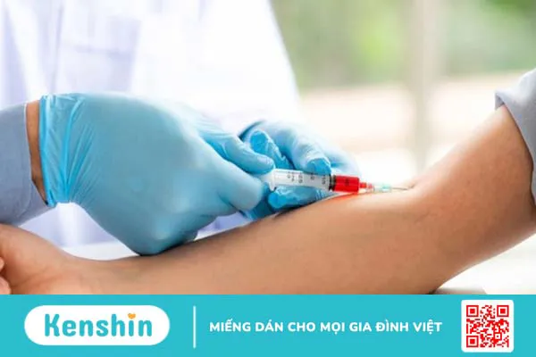 Viêm dây thần kinh cấp tính nguyên phát: Nguyên nhân, triệu chứng và điều trị 2