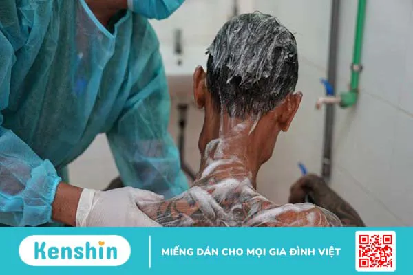 Viêm dây thần kinh ngoại biên: Nguyên nhân và triệu chứng gây bệnh 3