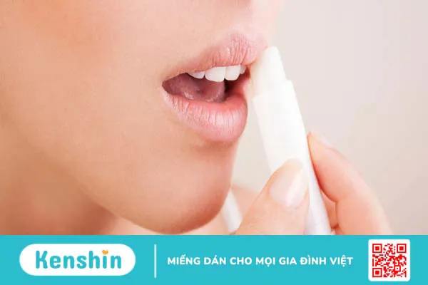 Viêm mép môi là bệnh gì? Cách điều trị như thế nào? 3