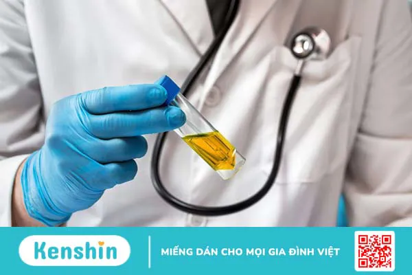 Viêm niệu đạo không do lậu có nguy hiểm không? 3